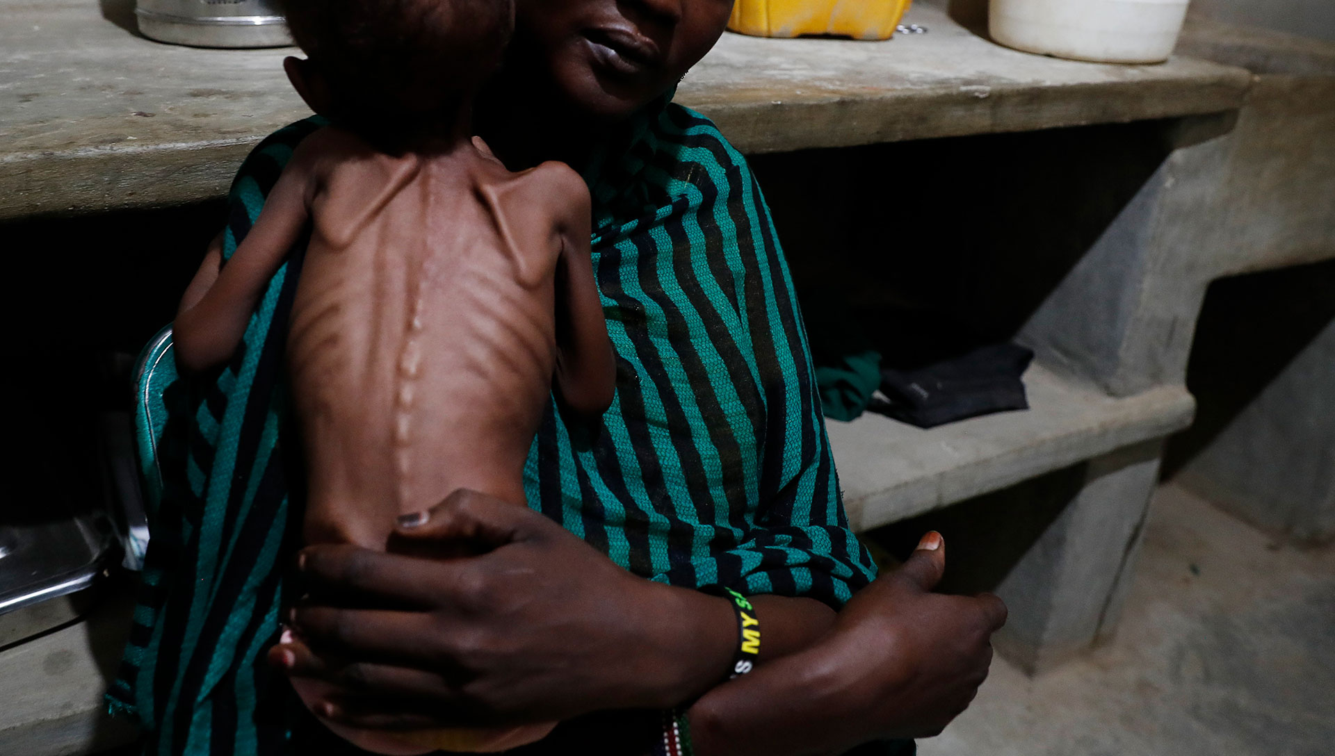 Hungry people in Africa